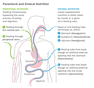 Nutritional Support Therapy